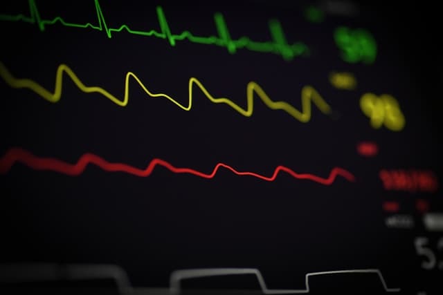 Health Coach Tip– What Is a Healthy Resting Heart Rate?