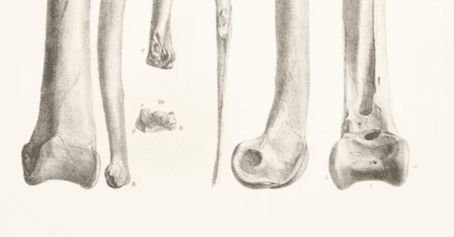No Bones About It
