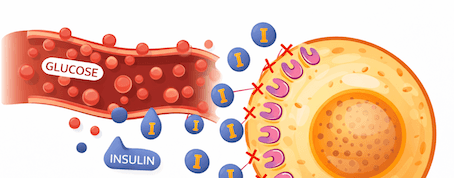 Health Coach Tip — What Is Insulin Resistance?