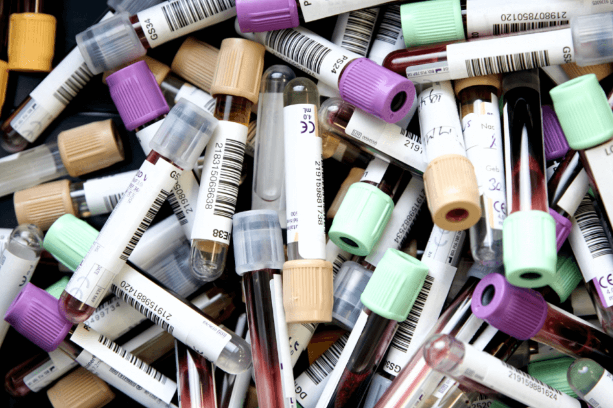 Apolipoprotein B: The Crucial Cardiovascular Biomarker Everyone Should Be Measuring