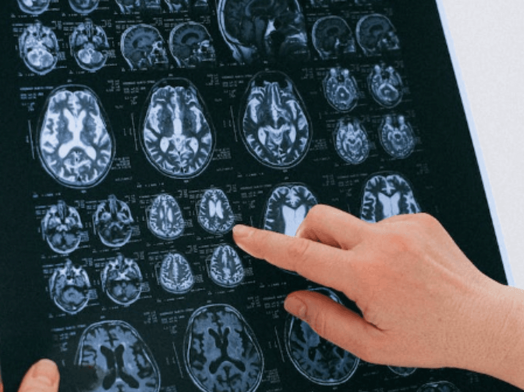 9 Things to Know About Optimizing Brain Function with Nootropics