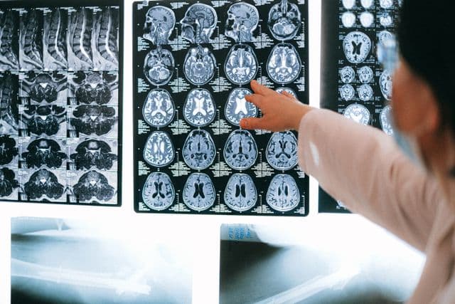 Building The Brain’s Hidden Superpower: Resilience