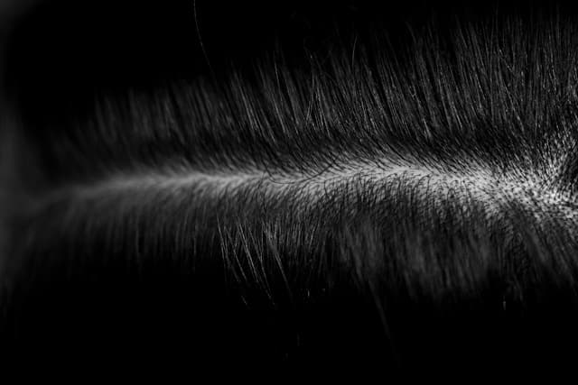 Does the Scalp Have a Microbiome?